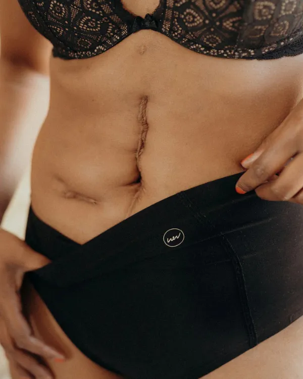 post op_resultat